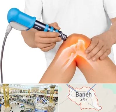 شاک ویو تراپی در بانه
