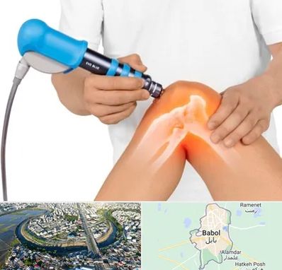 شاک ویو تراپی در بابل