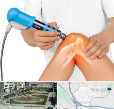 شاک ویو تراپی در مرزداران تبریز