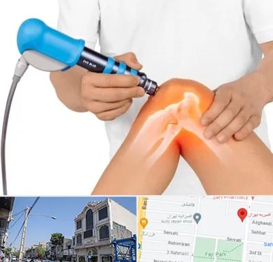 شاک ویو تراپی در افسریه