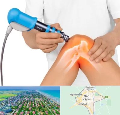 شاک ویو تراپی در ساری