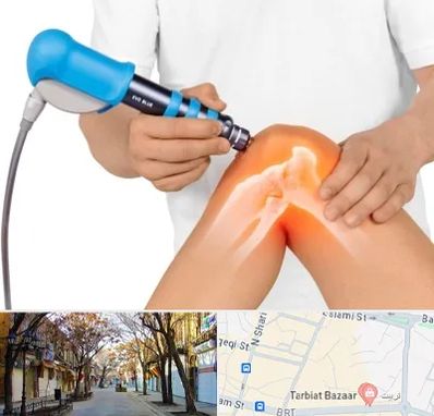 شاک ویو تراپی در تربیت تبریز