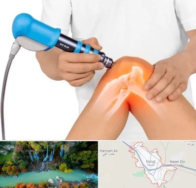 شاک ویو تراپی در دورود