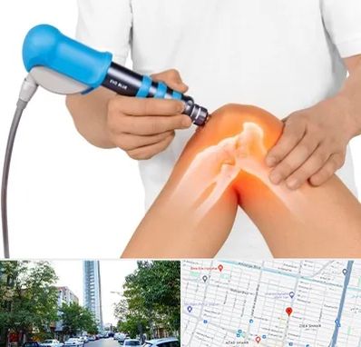 شاک ویو تراپی در امامت مشهد