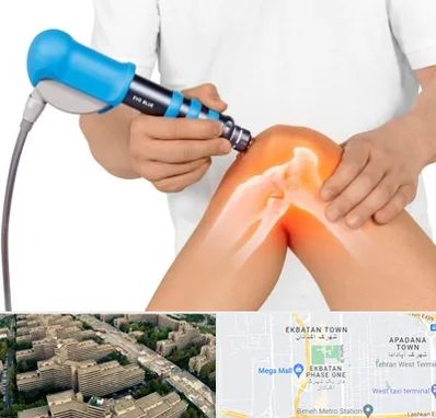 شاک ویو تراپی در اکباتان