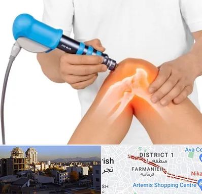 شاک ویو تراپی در فرمانیه