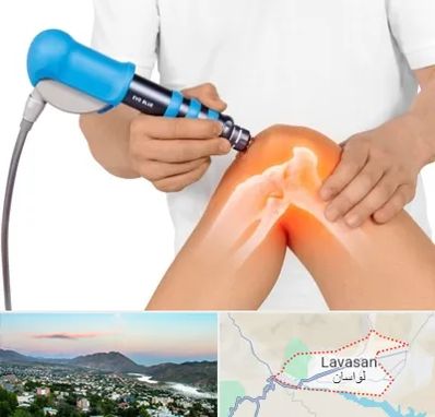 شاک ویو تراپی در لواسان