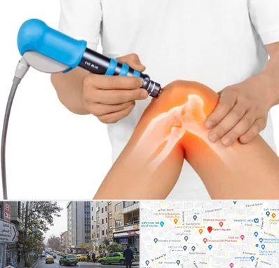 شاک ویو تراپی در فاطمی