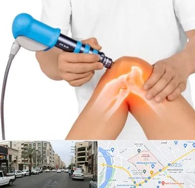 شاک ویو تراپی در زیتون کارمندی اهواز