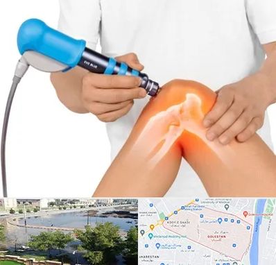 شاک ویو تراپی در گلستان اهواز