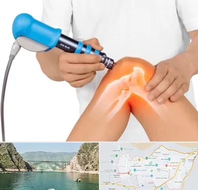 شاک ویو تراپی در ایلام