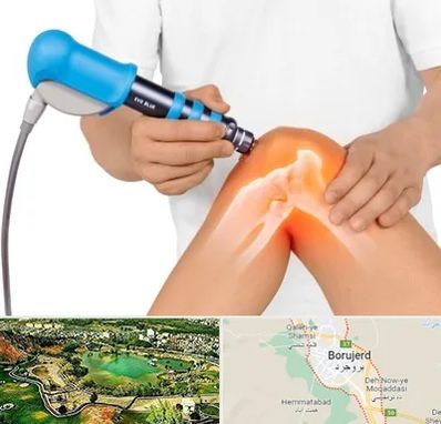 شاک ویو تراپی در بروجرد