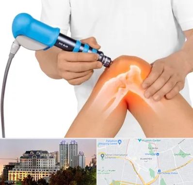 شاک ویو تراپی در فرشته