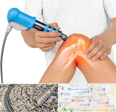 شاک ویو تراپی در شهرک غرب مشهد