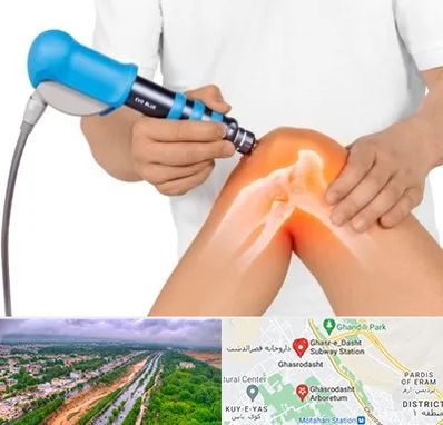 شاک ویو تراپی در قصرالدشت شیراز