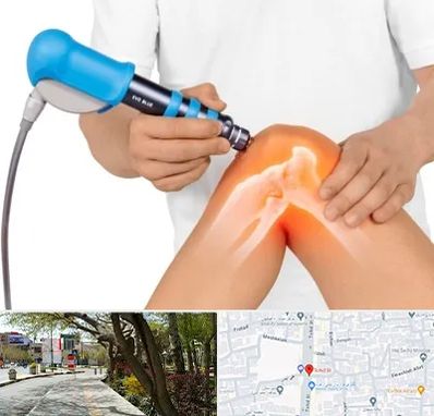 شاک ویو تراپی در خیابان توحید اصفهان