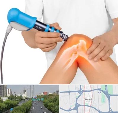 شاک ویو تراپی در توانیر