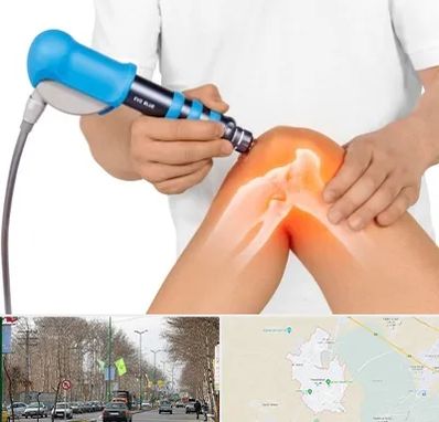 شاک ویو تراپی در نظرآباد کرج