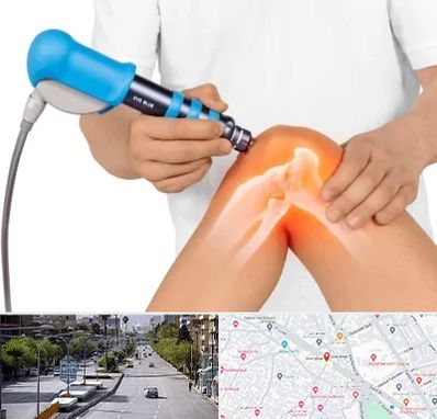 شاک ویو تراپی در خیابان زند شیراز