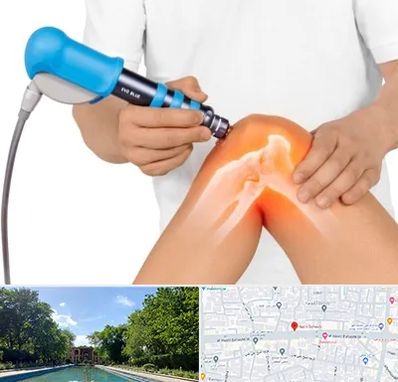 شاک ویو تراپی در هشت بهشت اصفهان