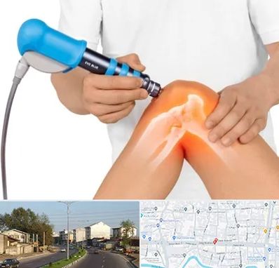 شاک ویو تراپی در ضیابری رشت