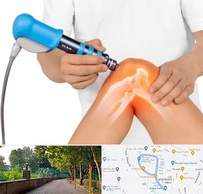 شاک ویو تراپی در فلکه گاز رشت