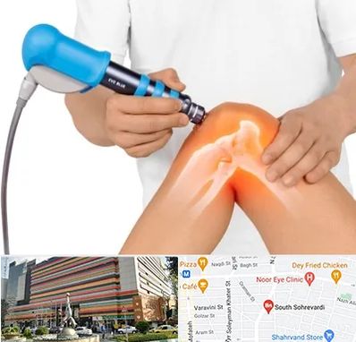 شاک ویو تراپی در سهروردی