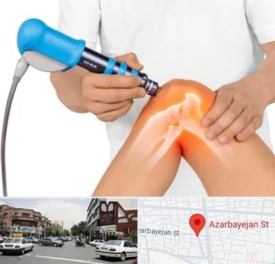 شاک ویو تراپی در خیابان آذربایجان