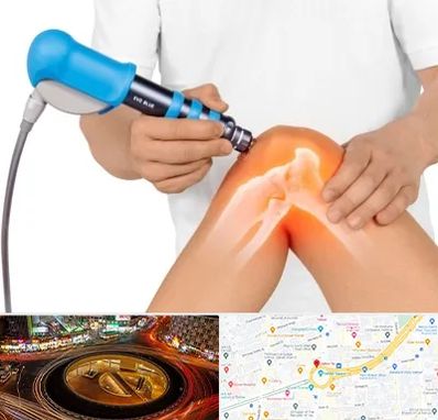 شاک ویو تراپی در میدان ولیعصر