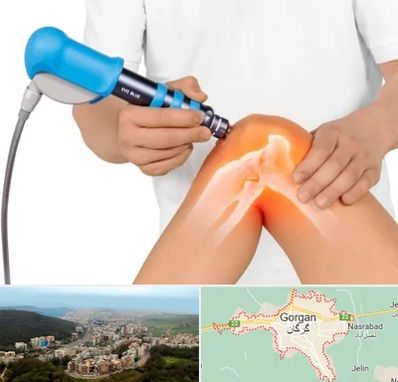 شاک ویو تراپی در گرگان