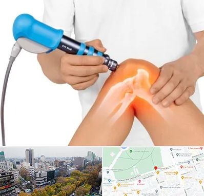 شاک ویو تراپی در بلوار کشاورز