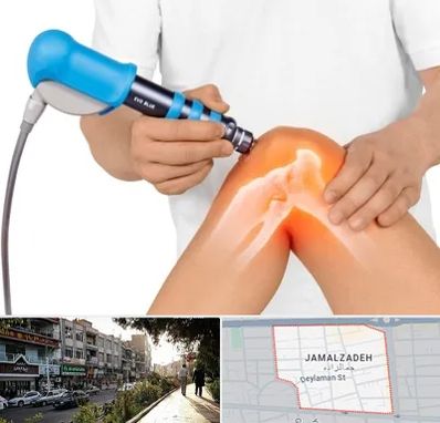 شاک ویو تراپی در خیابان جمالزاده