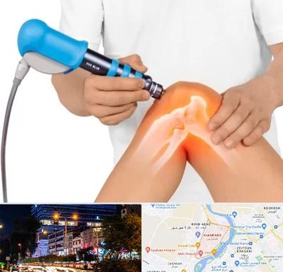 شاک ویو تراپی در کیانپارس اهواز