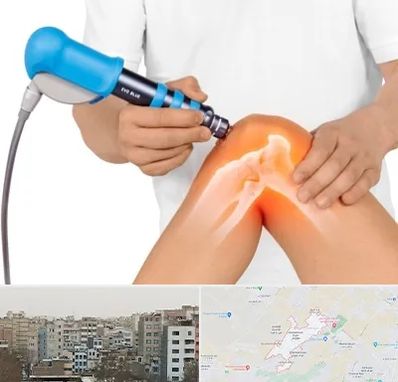 شاک ویو تراپی در محمد شهر کرج