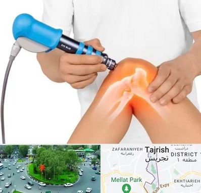 شاک ویو تراپی در تجریش