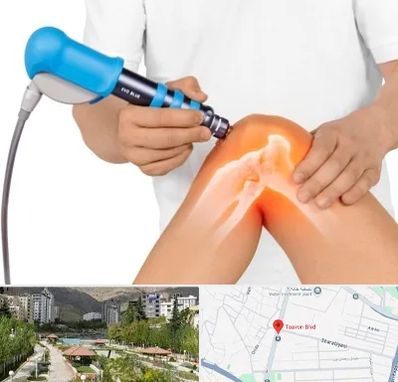 شاک ویو تراپی در بلوار تعاون