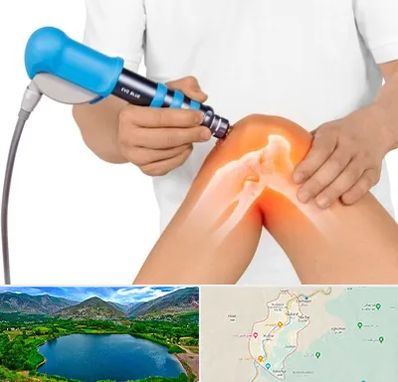 شاک ویو تراپی در رودبار