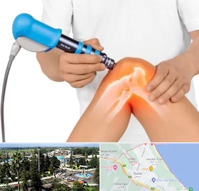 شاک ویو تراپی در رودسر