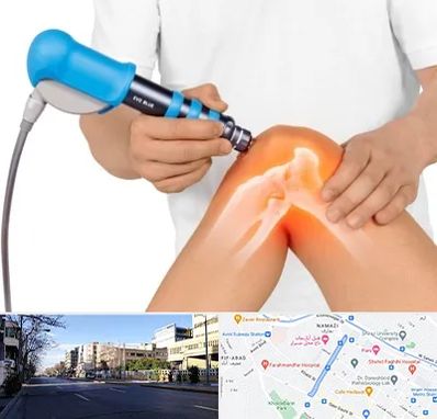 شاک ویو تراپی در خیابان ملاصدرا شیراز