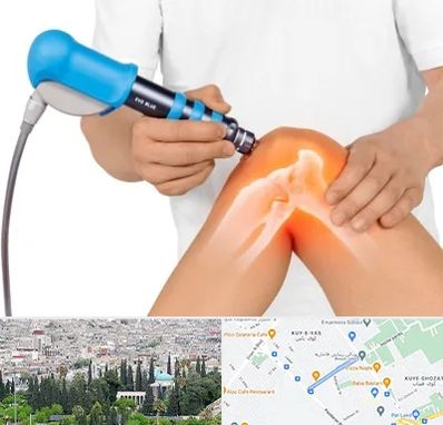 شاک ویو تراپی در محلاتی شیراز