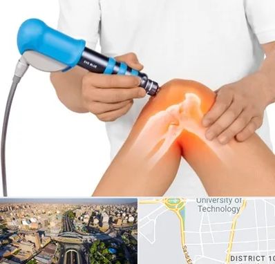 شاک ویو تراپی در استاد معین