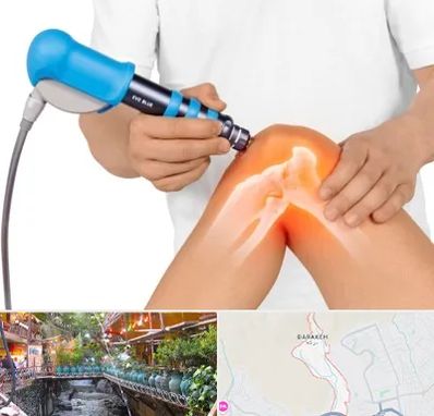 شاک ویو تراپی در درکه