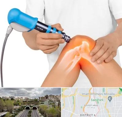 شاک ویو تراپی در یوسف آباد