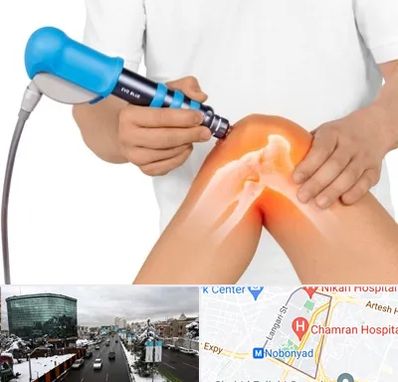 شاک ویو تراپی در اقدسیه