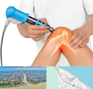 شاک ویو تراپی در تنکابن