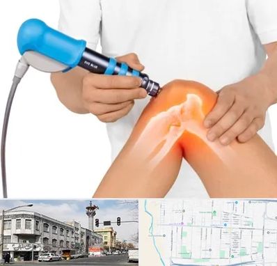 شاک ویو تراپی در 17شهریور