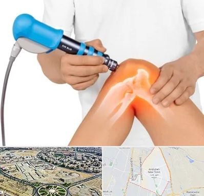 شاک ویو تراپی در اندیشه