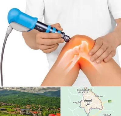 شاک ویو تراپی در آمل