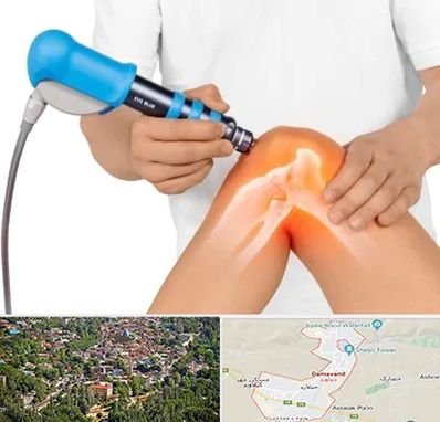 شاک ویو تراپی در دماوند