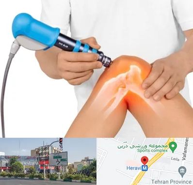 شاک ویو تراپی در هروی